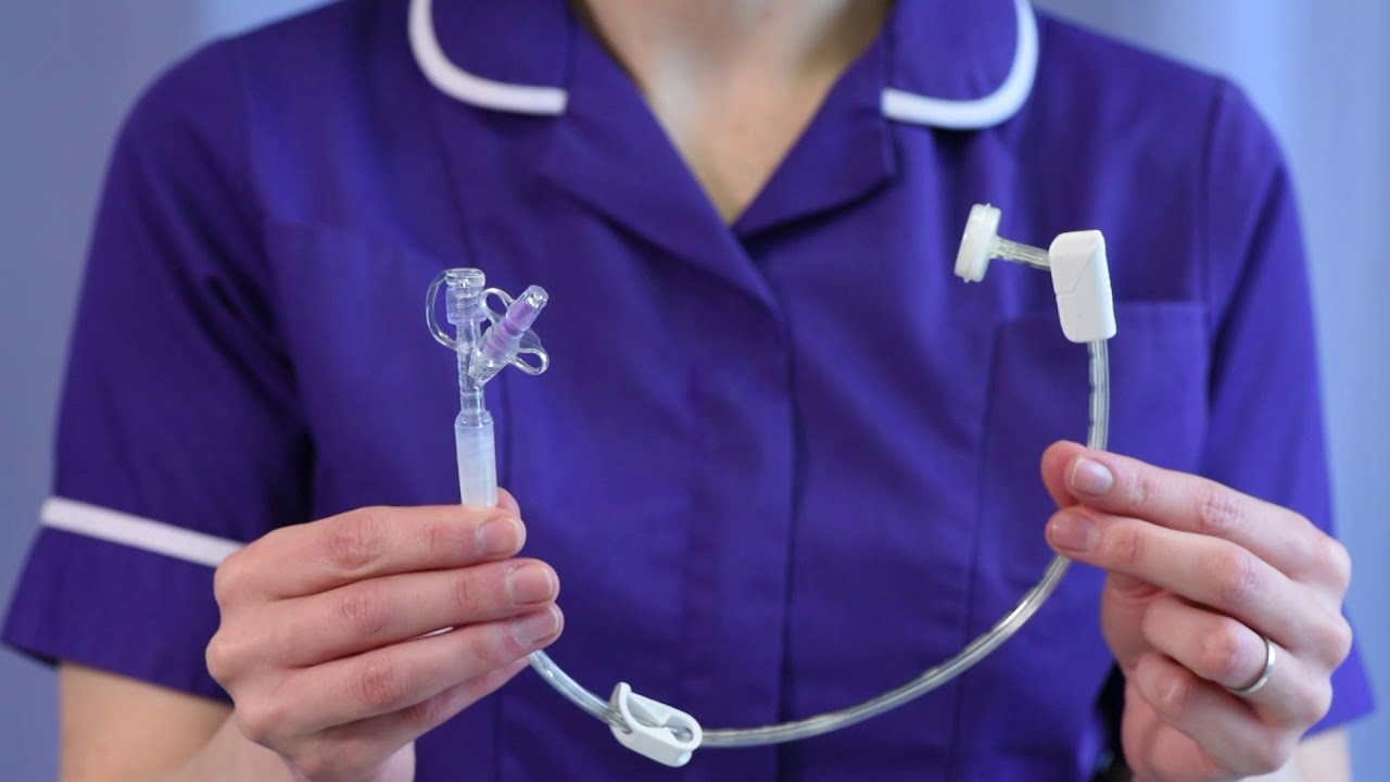 لوله پگ (PEG) برای معده چیست و چه کاربردی دارد؟ لوله پگ (PEG) برای معده چیست و چه کاربردی دارد؟