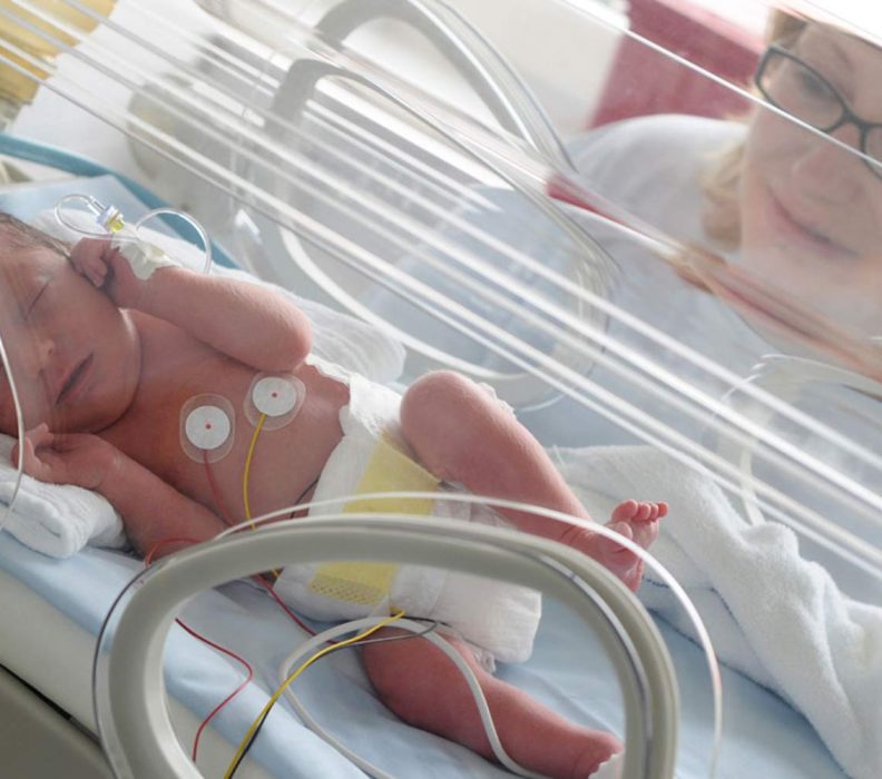 لوله تغذیه در بخش مراقبتهای ویژه نوزادان (NICU)