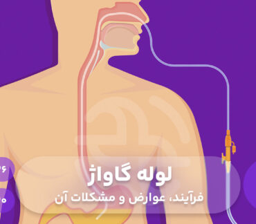لوله گاواژ