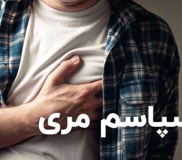اسپاسم مری