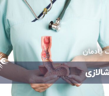 آشالازی