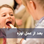 بلع بعد از عمل لوزه