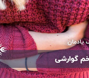زخم گوارشی