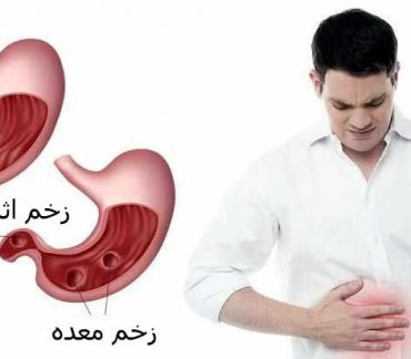 زخم اثنی عشر
