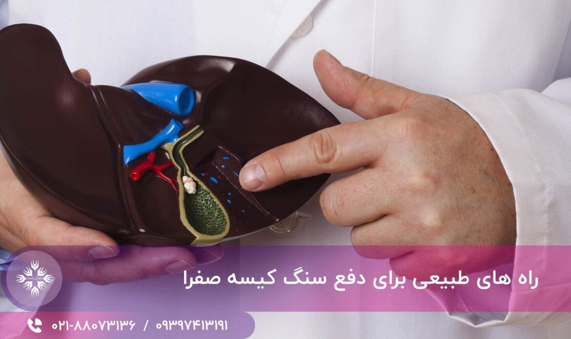 دفع سنگ کیسه صفرا