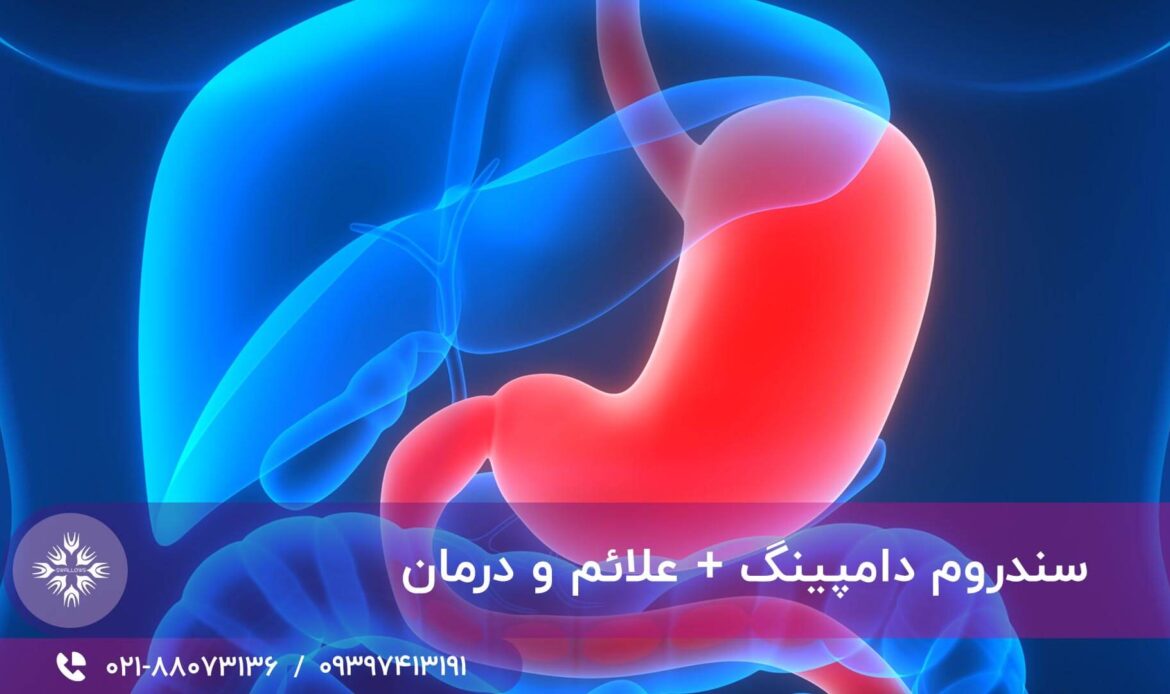 سندروم دامپینگ