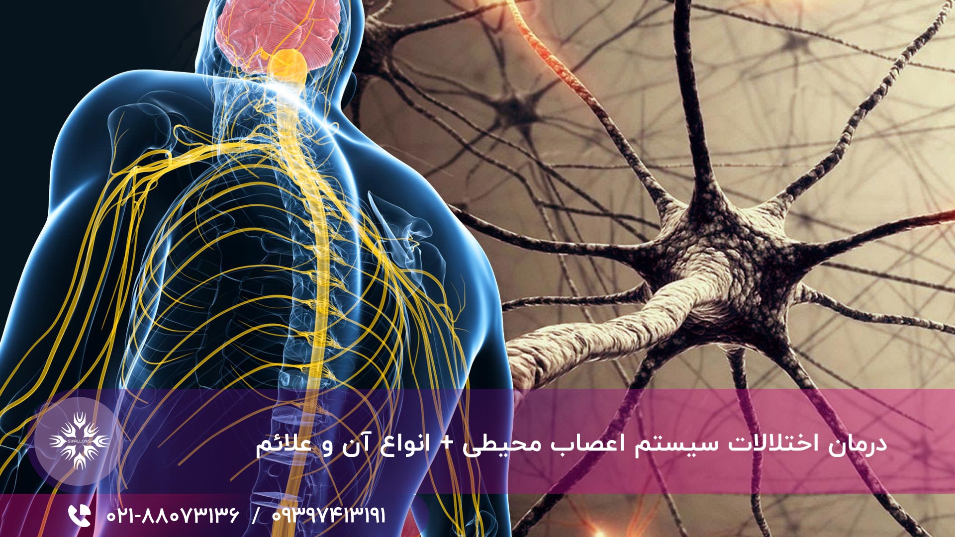 درمان اختلالات سیستم اعصاب محیطی + انواع آن و علائم