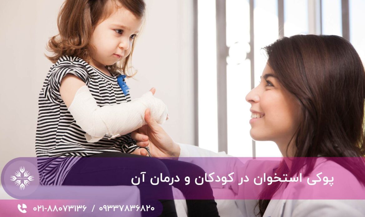 پوکی استخوان در کودکان