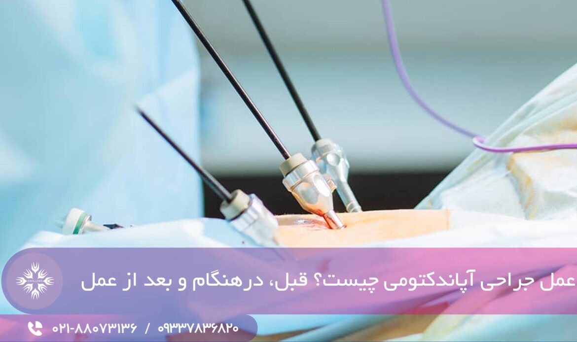 آپاندکتومی چیست