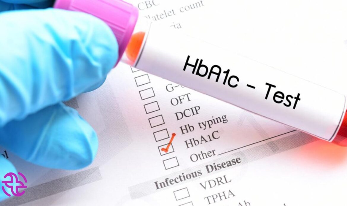آزمایش هموگلوبین H1C (HgH1C)