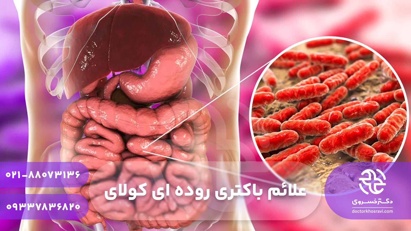 علائم باکتری روده ای کولای
