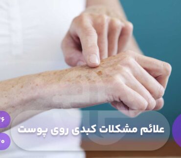 علائم مشکلات کبدی روی پوست